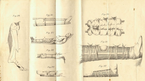 Afbeelding 3 - Gids voor den ziekendrager, Toegang 3550 inv.nr. 10.. Figuren 24 tm 32